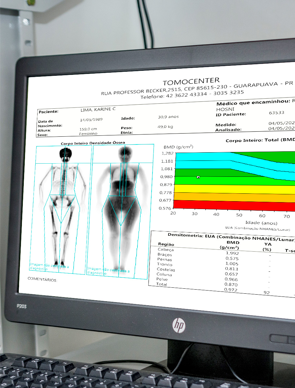 Densitometria Óssea